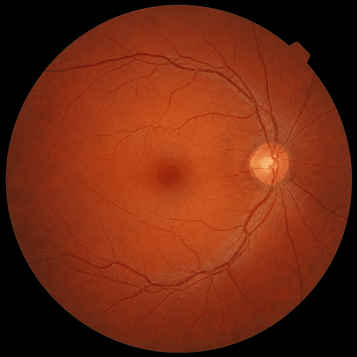 The retina at the back of the eye