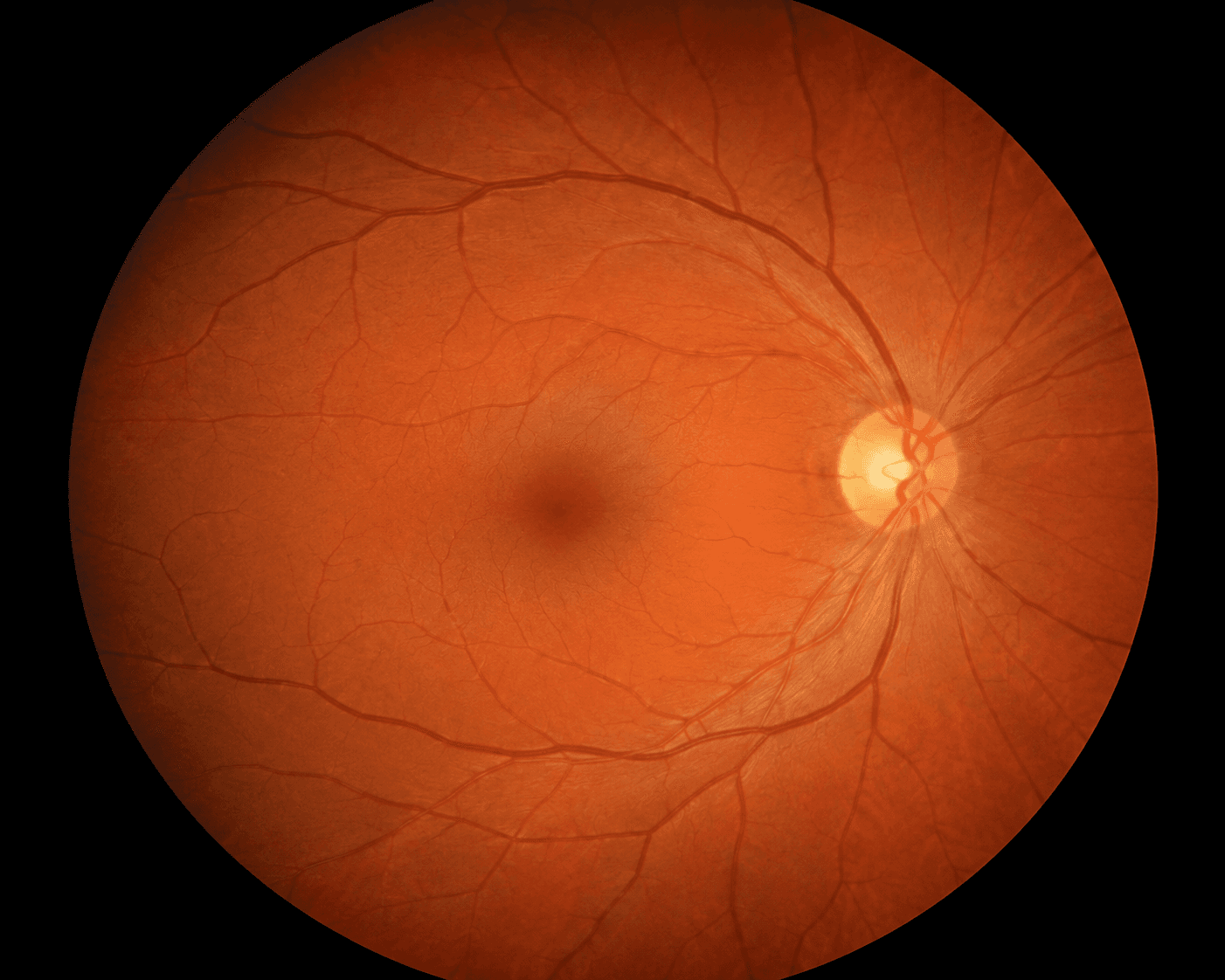 Fundus Photography