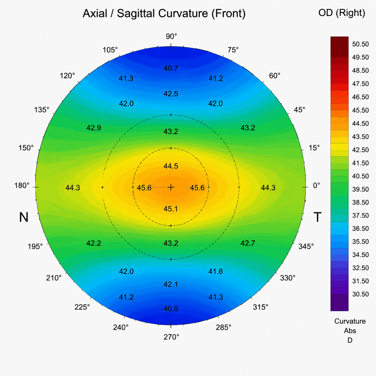 Corneal Topography