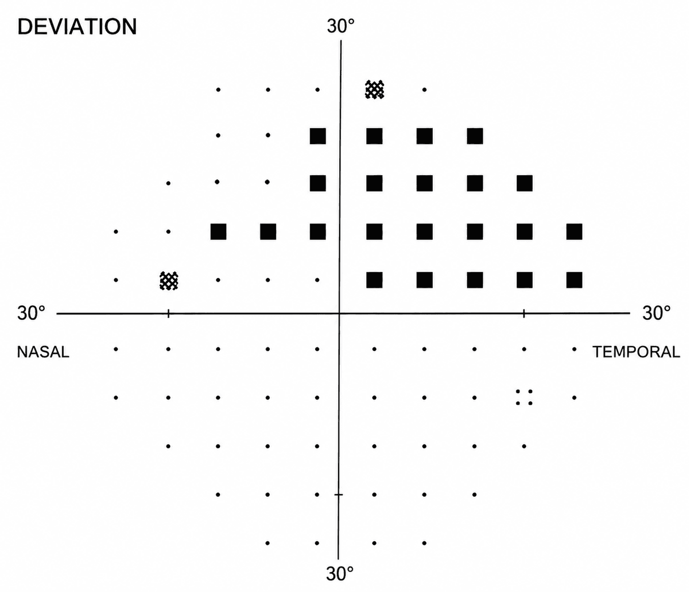 Visual Field Testing